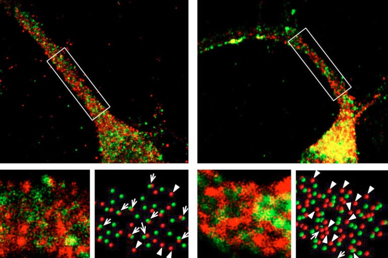 A new study shows that when the gene Foxp2 is knocked out in mouse striatal neurons (top right panel), the protein dynactin (stained red) and the chain that binds dynactin and dynein (stained green) show abnormal spacing compared to wildtype neurons (top left panel). This suggests that the functions of the motor complexes formed by these proteins may be impaired. The bottom panels show close-ups of the green and red labeled molecules. Credits: Fu-Chin Liu للاستخدام الداخلي فقط