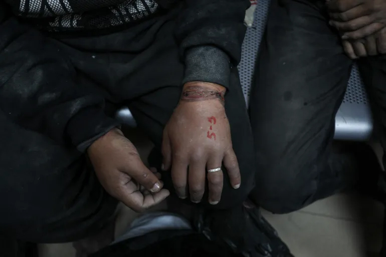 One of the Palestinian men arrested and tortured for days by Israeli soldiers shows the number he was marked with and his swollen hands from the handcuffs [Abdelhakim Abu RiashAl Jazeera]