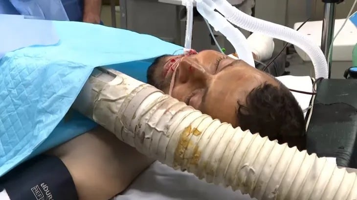  أول تعليق لمراسل الجزيرة إسماعيل أبو عمر بعد بتر قدمه.. الاحتلال أغرقنا بالدم