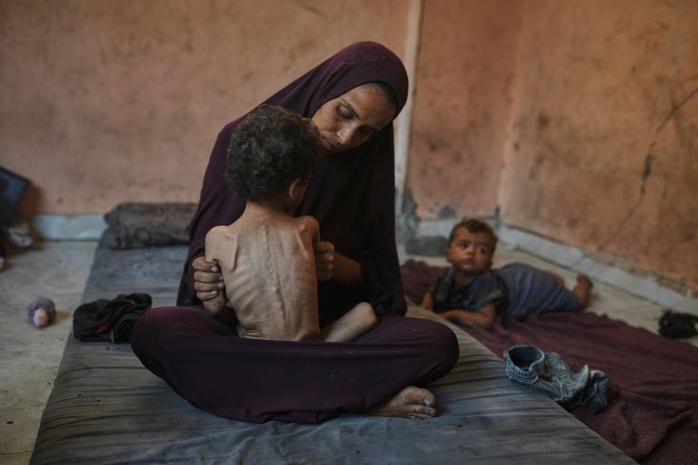 Naima Abu Ful poses for a photo with her 2-year-old malnourished child, Yazan, at their home in the Shati refugee camp in Gaza City, Wednesday, July 23, 2025. (AP Photo/Jehad Alshrafi)