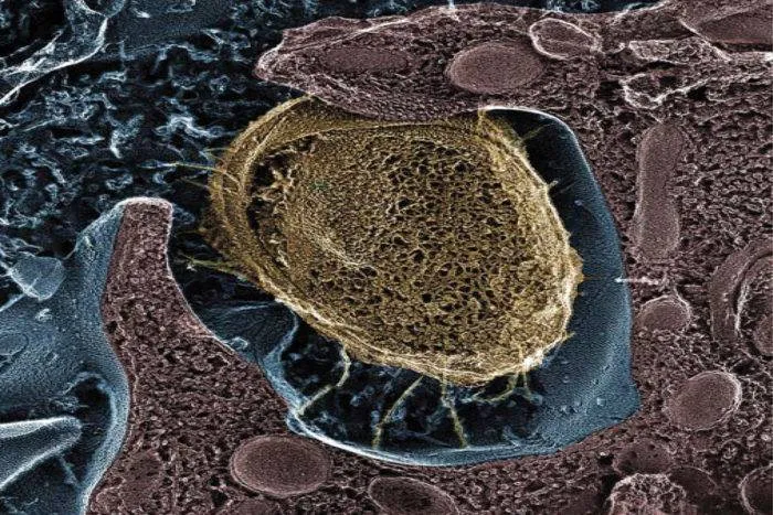 ما أبرز أعراض التهاب المسالك البولية؟