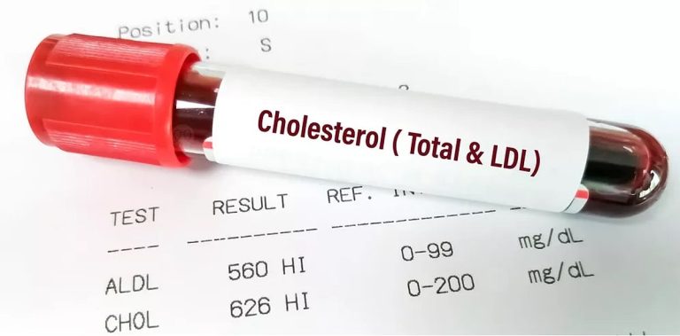 مرضى القلب والضغط يجب أن يحافظوا على مستوى الكوليسترول الضار منخفض