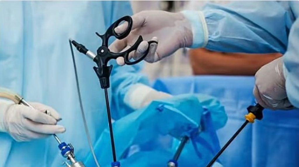 12 سببا تزيد احتمال عدم كفاية تحضير القولون قبل المنظار