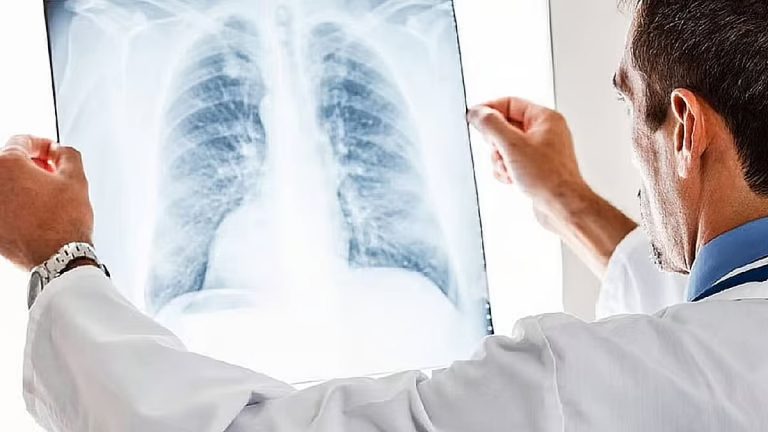 الصحة: يمكن الوقاية من 30 إلى 50 % من حالات السرطان